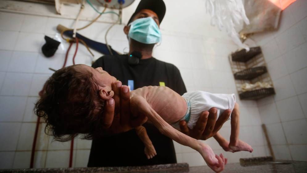 গাজায় অপুষ্টিতে ৬৬ শিশুর মৃত্যু