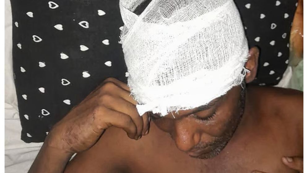 নাটোরে জামায়াত-বিএনপি সংঘর্ষ, আহত ১০