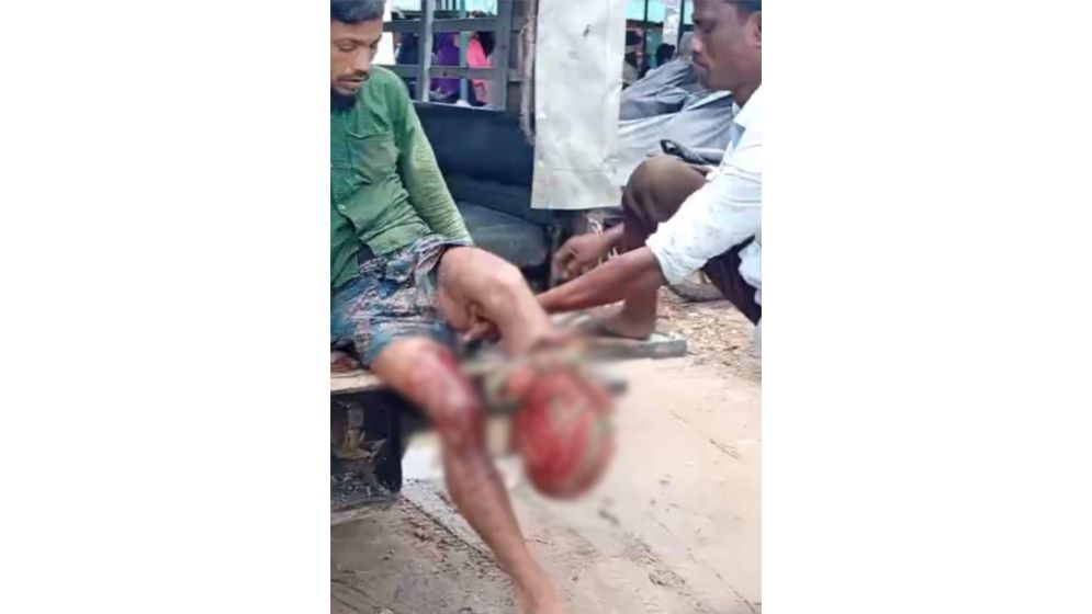 ঘুমধুম সীমান্তে মাইন বিস্ফোরণে বাংলাদেশি যুবকের পা বিচ্ছিন্ন