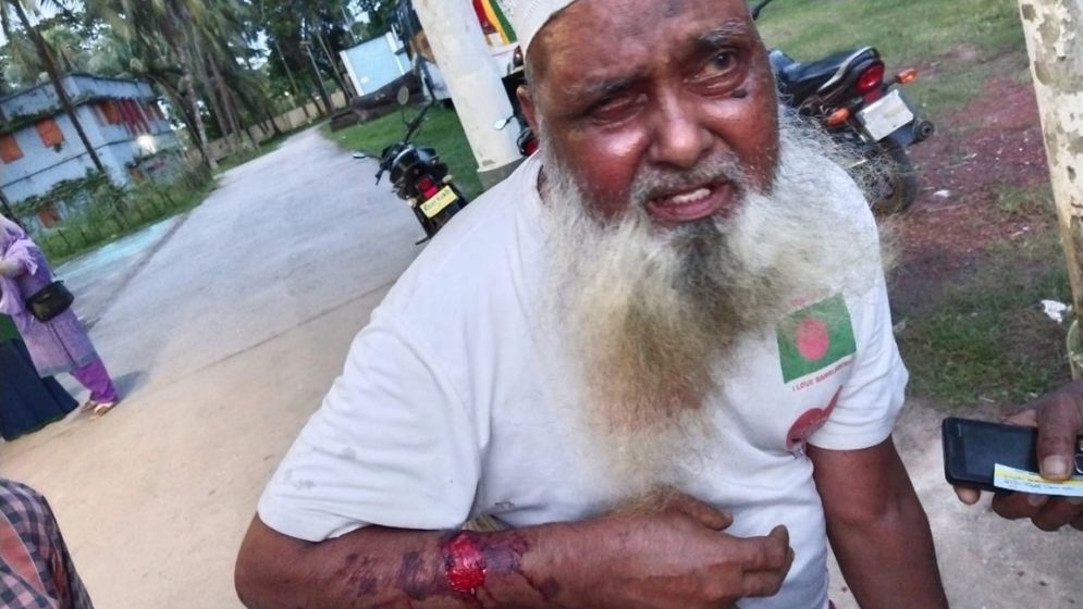 বৃদ্ধ শ্বশুরকে নির্যাতন,পিটিয়ে হাসপাতালে ভর্তি