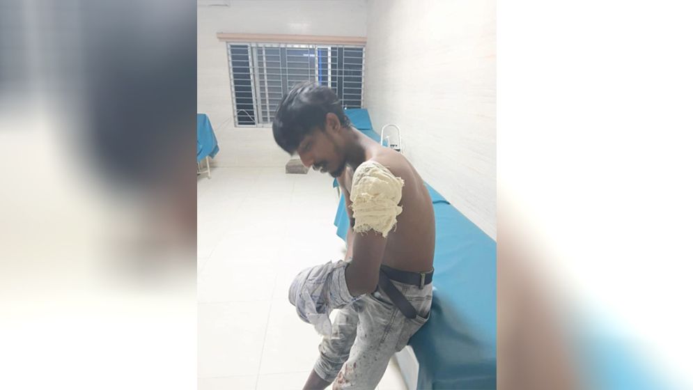 বগুড়ায় স্ত্রী তালাকের দ্বন্দ্বের জেরে একে উপরের ছুরিকাঘাতে দুই বন্ধু আহত