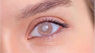 ছানি রোগে আক্রান্ত ৯ কোটি মানুষ, দ্রুত পদক্ষেপ নিতে আহ্বান ডব্লিউএইচওর