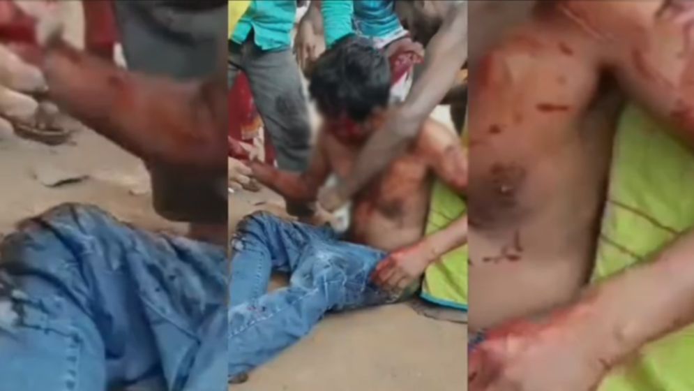 রূপগঞ্জে পারিবারিক কলহে স্বামীকে কুপিয়ে জখম করেছেন মহিলা দলের নেত্রী