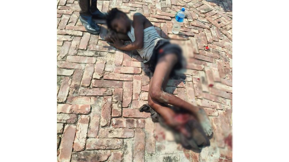 উখিয়া সীমান্তে মাইন বিস্ফোরণে রোহিঙ্গা কিশোরের পা বিচ্ছিন্ন