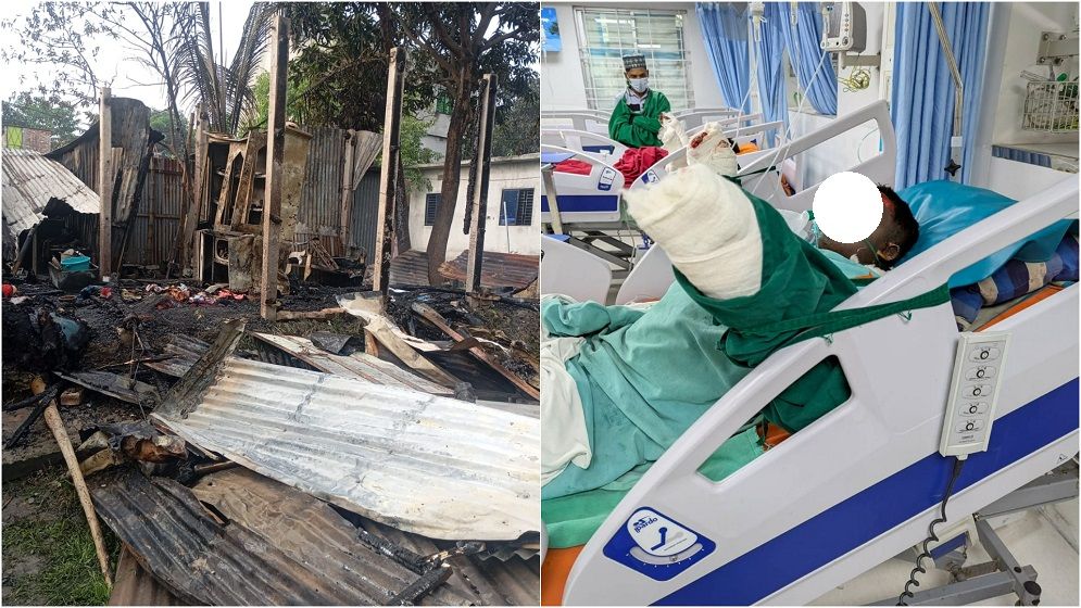 রূপগঞ্জে বিধবার বসতবাড়িতে অগ্নিকান্ডের ঘটনায় দগ্ধ ছেলের মৃত্যু