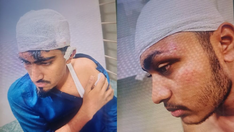 রূপগঞ্জে পাওনা টাকা চাওয়ায় ভাবি-ভাতিজাকে কুপিয়ে জখম