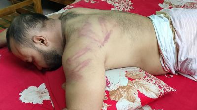রূপগঞ্জে সাংবাদিকের ওপর সন্ত্রাসী হামলা, মোটরসাইকেল ও নগদ টাকা লুট