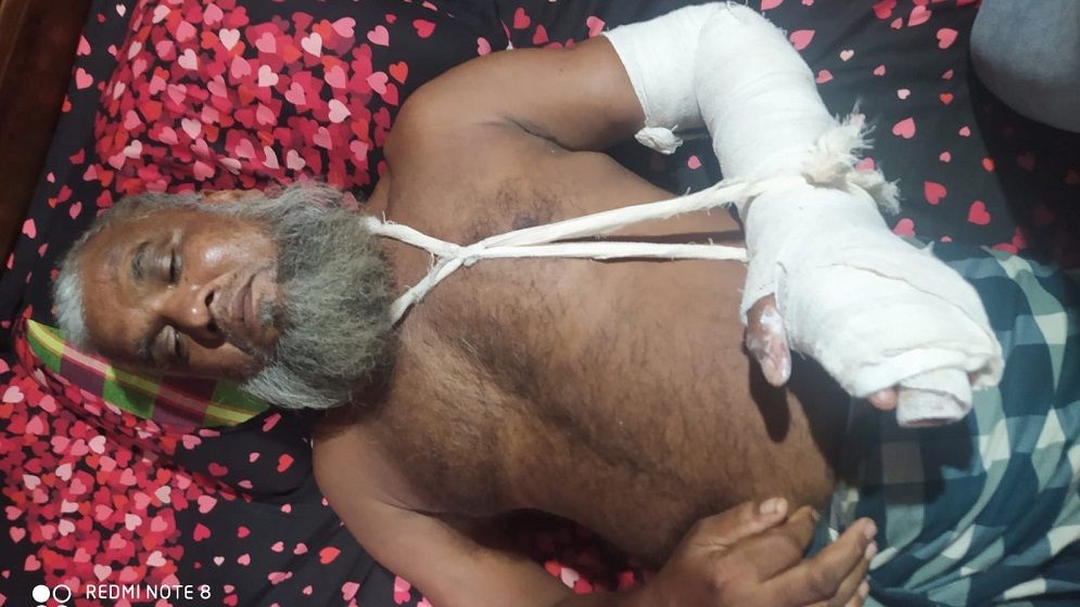 রূপগঞ্জে হামলা-ভাংচুর ও স্বামী-স্ত্রীকে কুপিয়ে জখম