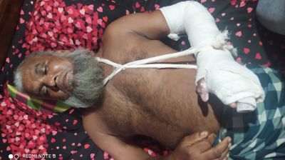 রূপগঞ্জে হামলা-ভাংচুর ও স্বামী-স্ত্রীকে কুপিয়ে জখম