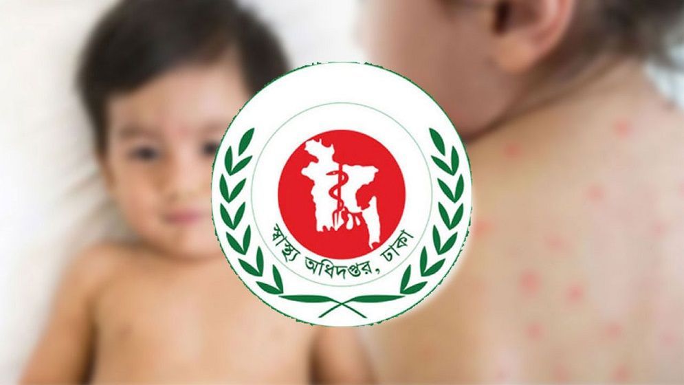হাম উপসর্গে একদিনে আরও ৪ প্রাণহানি