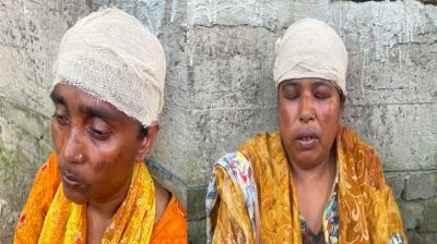 সোনারগাঁয়ে কিশোরীসহ ৩ নারীকে কুপিয়ে জখম
