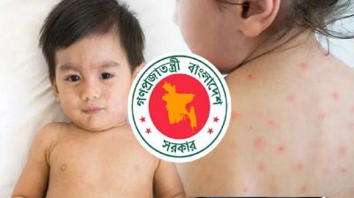 হাম উপসর্গে আরও ৪ শিশুর মৃত্যু