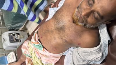 রূপগঞ্জে বিএনপির নেতাকে কুপিয়ে জখম
